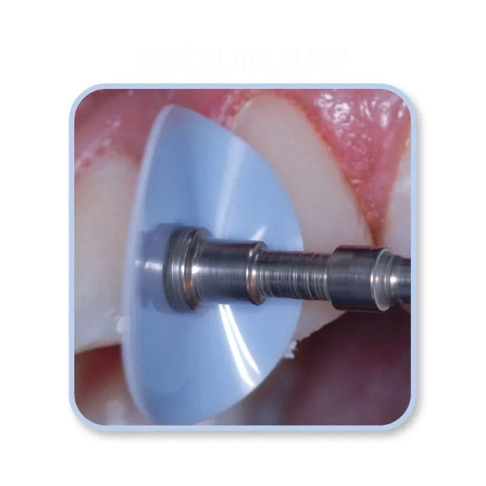 Composite Finishing & Polishing Disc Kit